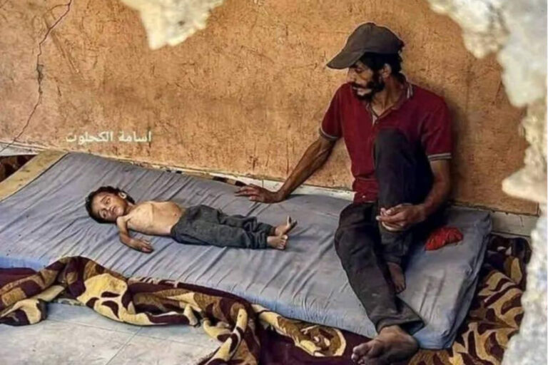 Otra falsa imagen de un niño en Gaza: incluso fue atendido en hospitales israelíes