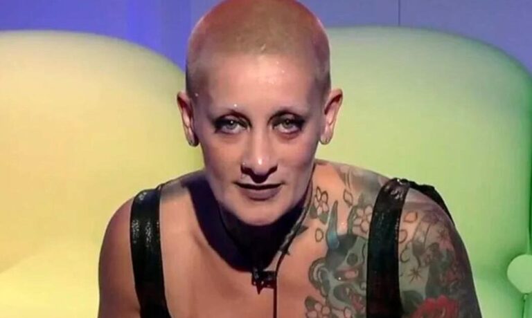 El antes y después de Furia Scaglione que se hizo viral tras retocarse los labios