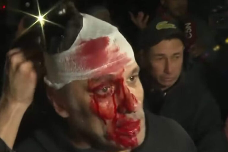 Nefasto: militantes kirchneristas partieron la cabeza de un periodista con una botella