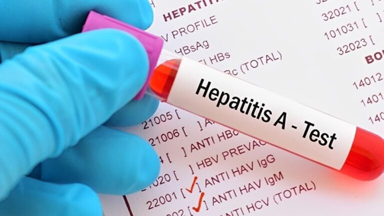 Mapa de Argentina con zonas de alerta sanitaria por hepatitis A