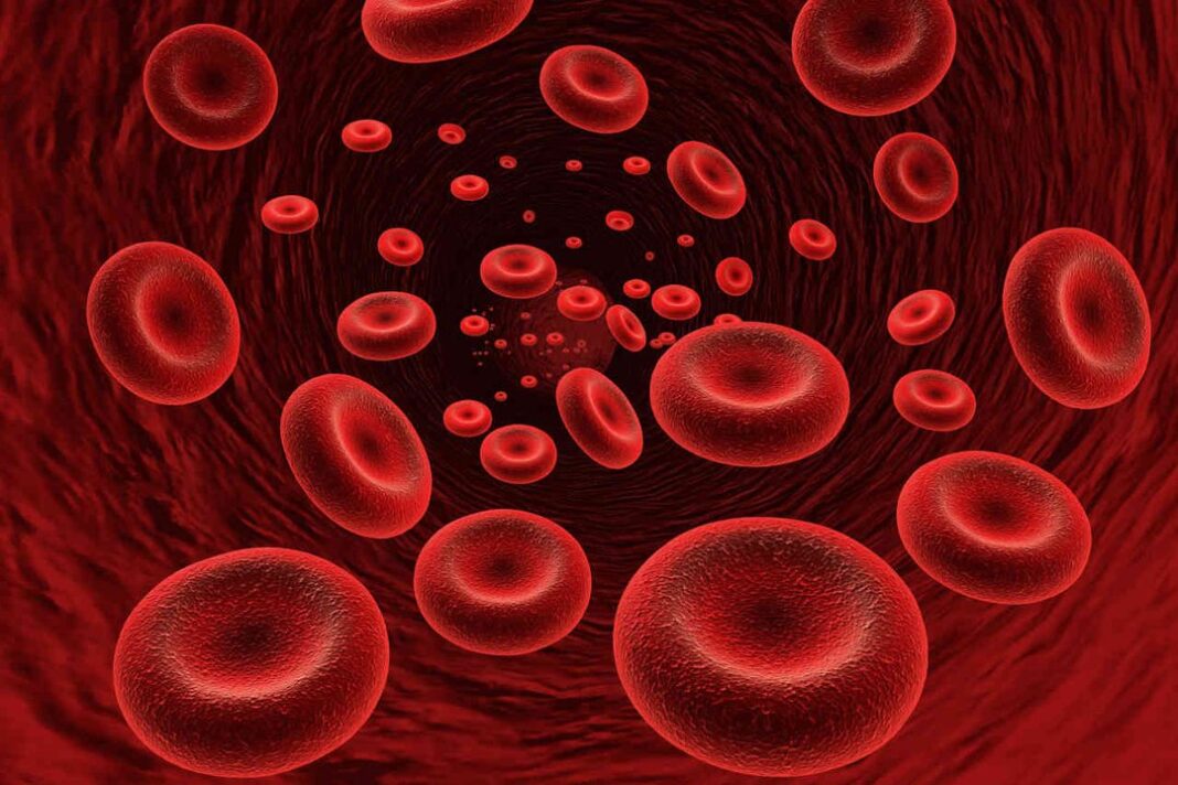 Ilustración de médula ósea con fibrosis y glóbulos rojos