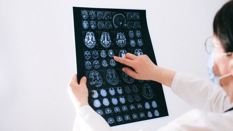 Ilustración de un cerebro humano con señales de alerta de ACV